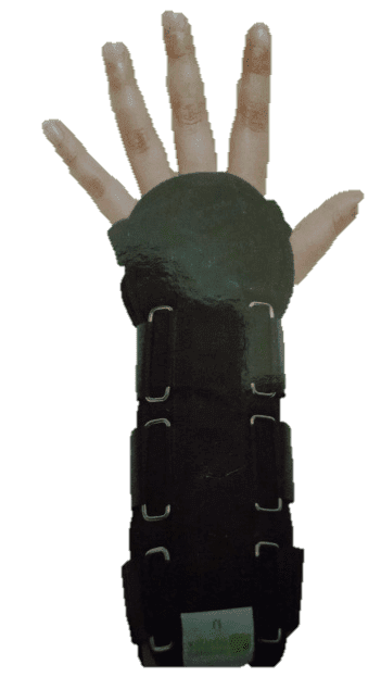 Férula para Muñeca y Antebrazo Universal